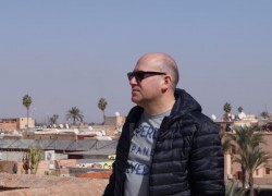 Haartransplantation Istanbul – nachhaltige und günstige Lösungen auf höchstem medizinischen Niveau